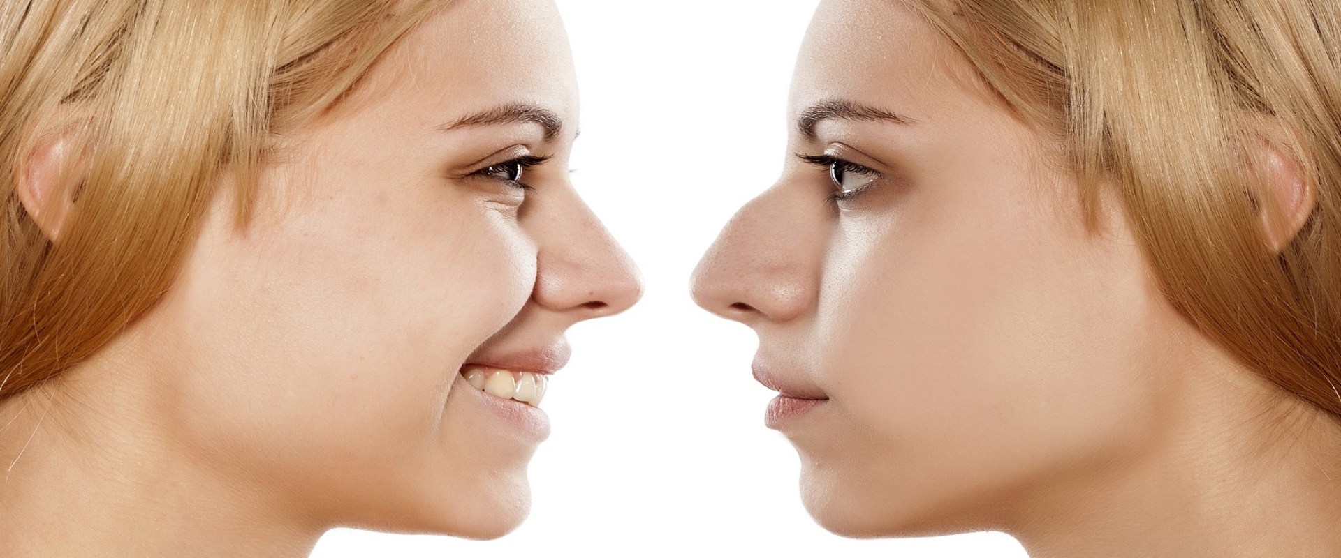 The True Cost of Rhinoplasty: How to Budget for a Life-Changing Nose Job