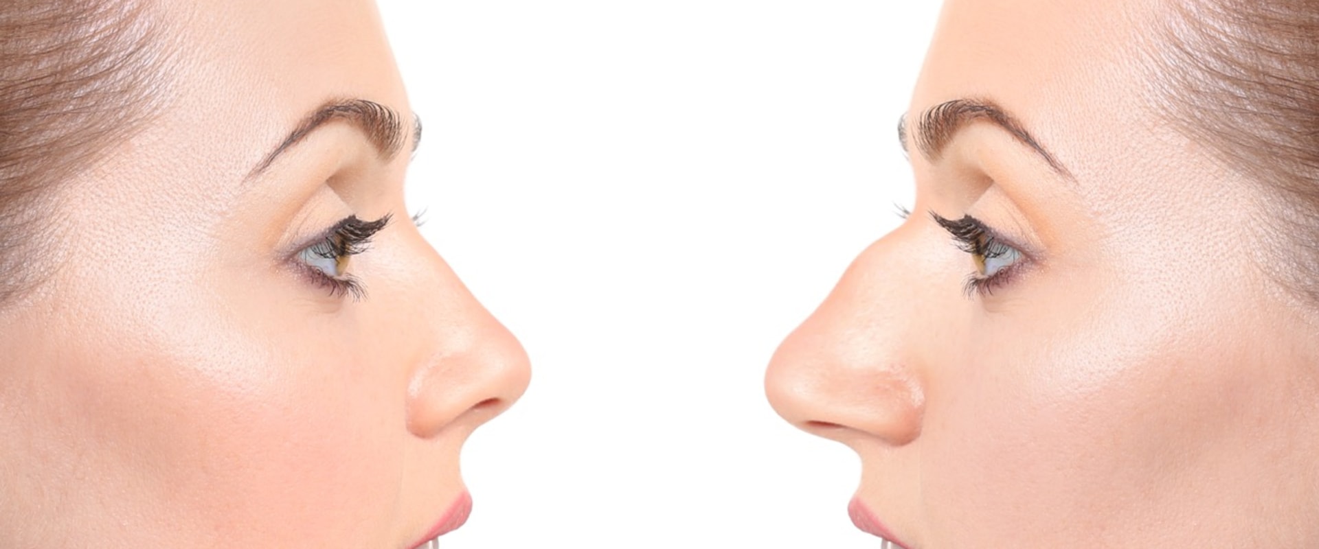 The Top Destinations for Affordable Rhinoplasty